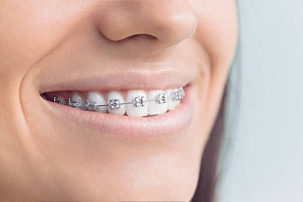 Best Wisdom Tooth Removal  in Millville, NJ